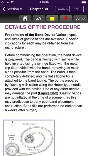 Atlas of Min. Invasive Surgery截图4