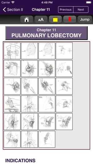 Atlas of Min. Invasive Surgery截图3