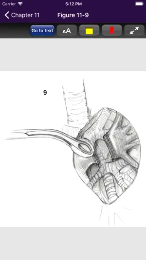 Atlas of Min. Invasive Surgery截图6