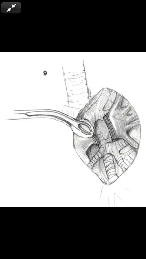 Atlas of Min. Invasive Surgery截图7