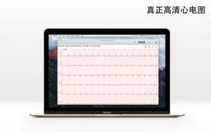 ECG Pro - 12导联静态和动态心电图案例截图1