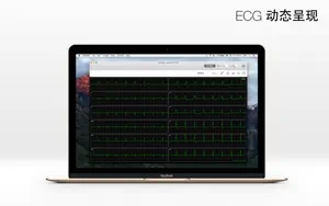 ECG Pro - 12导联静态和动态心电图案例截图2