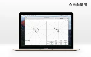 ECG Pro - 12导联静态和动态心电图案例截图4